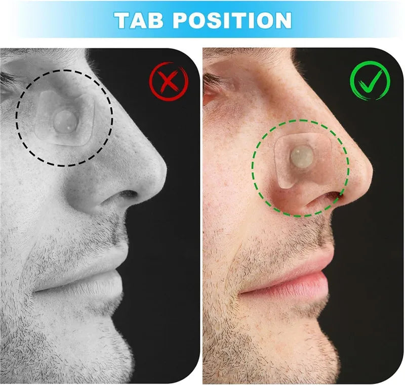 Magnetic Nasal Breathing Dilator Kit