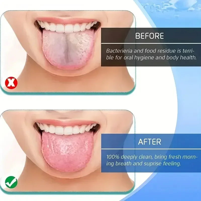 Stainless Steel U-Shaped Tongue Scraper.