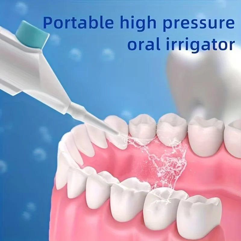 Portable Manual High-Pressure Oral Irrigator