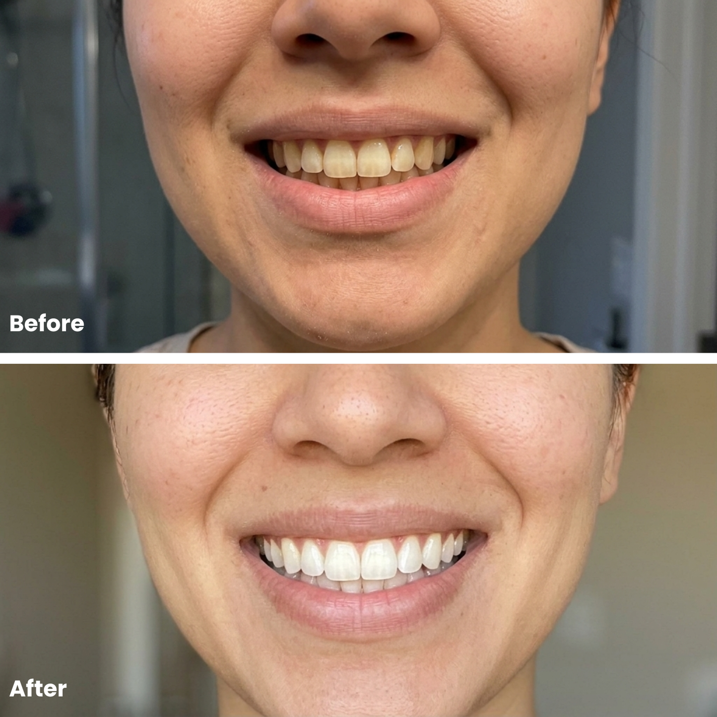 Purple Teeth Whitening Mouthwash – Instant Colour Correcting Formula