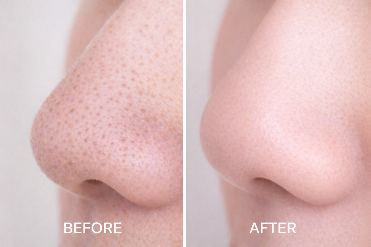 The Pore Purifier™ | Deep Cleansing Charcoal Strips Makeup art