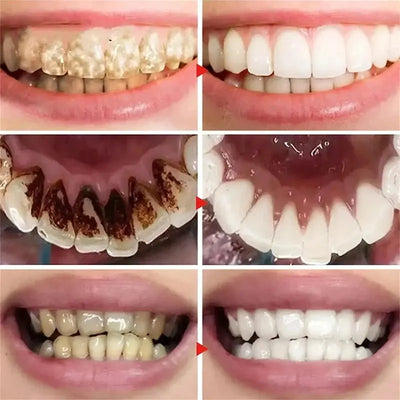 New Teeth Whitening Toothpaste 5D Teeth Whitening Stick Oral Hygiene Cleaning Teeth Whitening Tool Fresh Breath Teeth Care New Makeup art