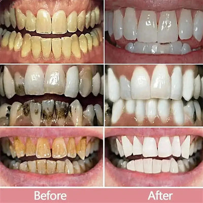 New Teeth Whitening Toothpaste 5D Teeth Whitening Stick Oral Hygiene Cleaning Teeth Whitening Tool Fresh Breath Teeth Care New Makeup art